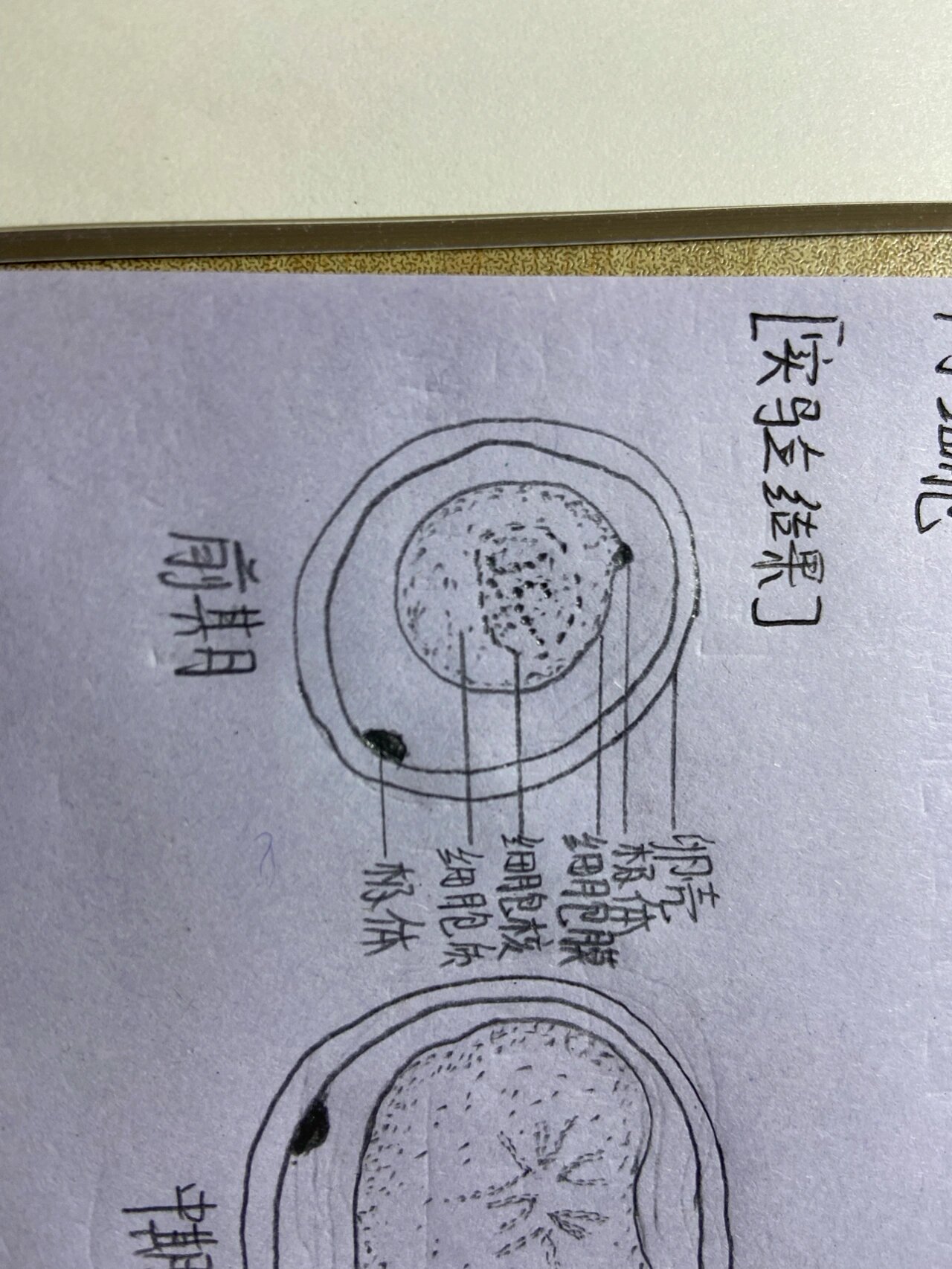 十二指肠钩虫口囊手绘图片