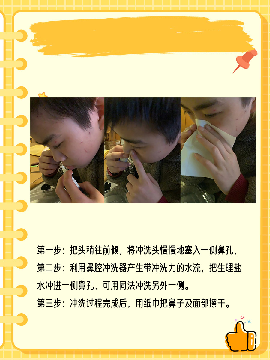 儿童鼻窦炎能自愈?可能性小!要做好日常护理