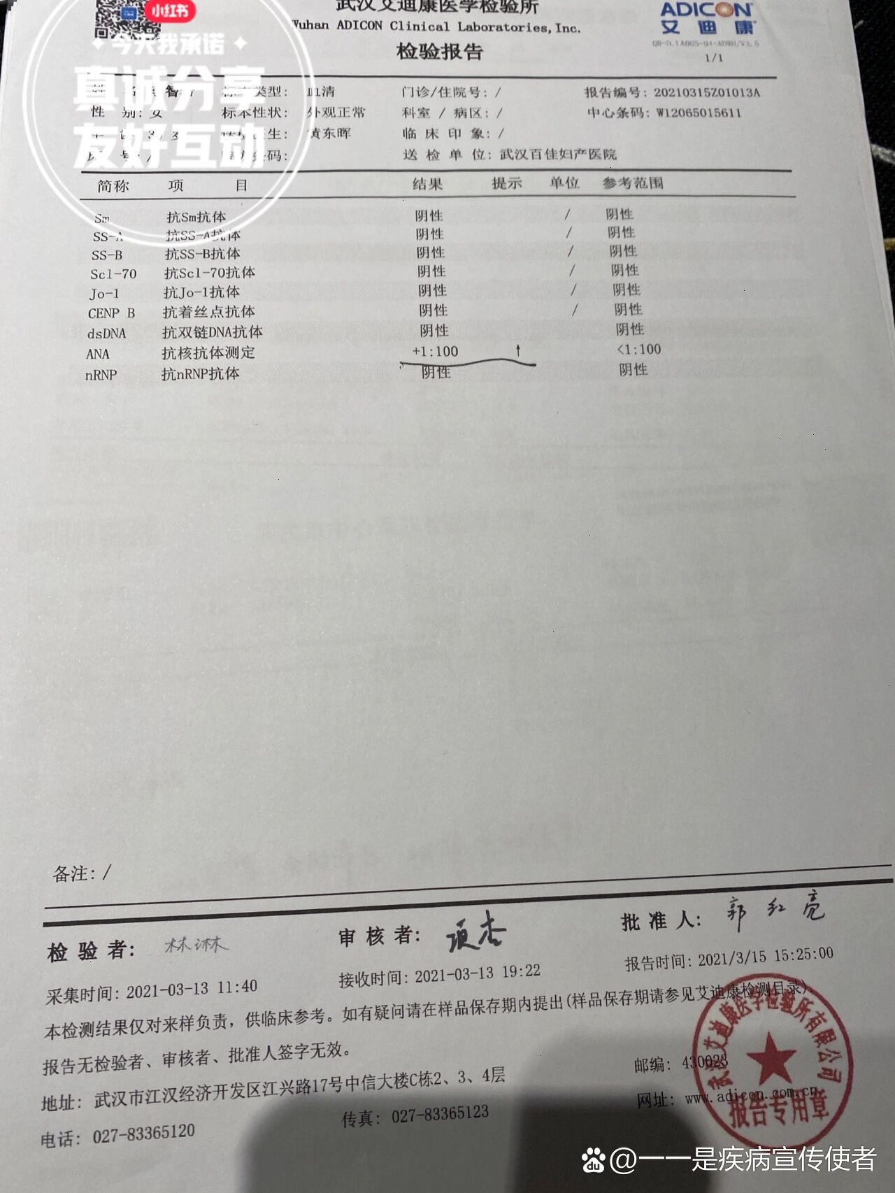 历经一年的抗核抗体阳性转阴