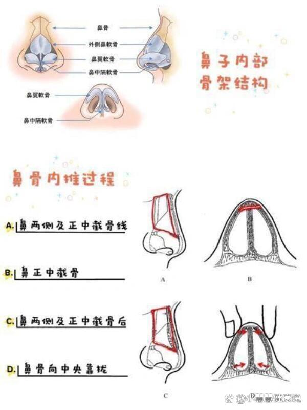 鼻中隔软骨被撞到是非常痛彻心扉的