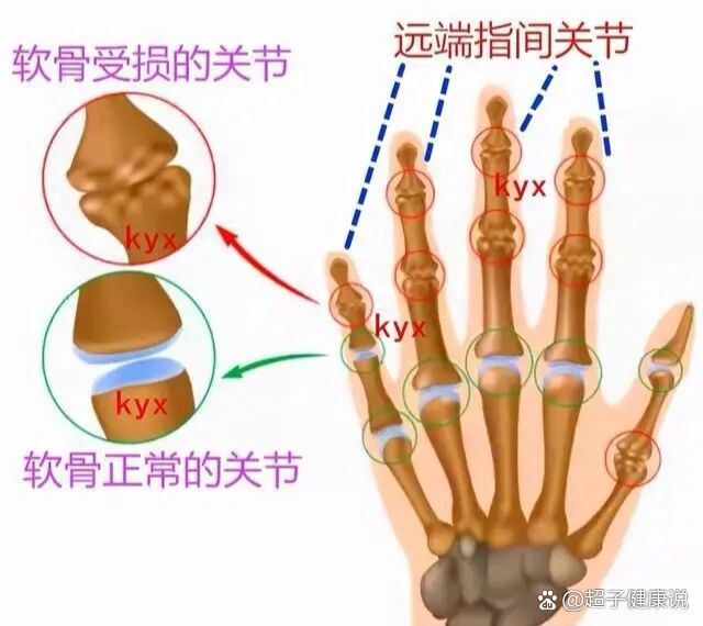 手指关节图片及名称图片