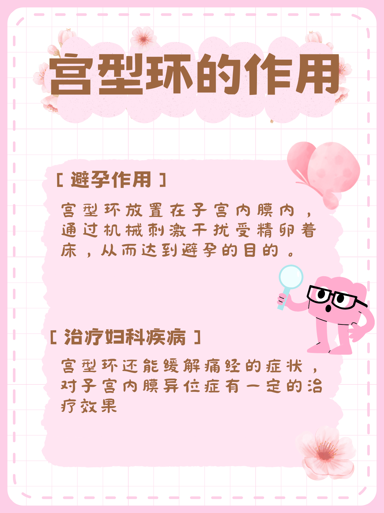 宫型环的耐用期限:究竟能放置多久?