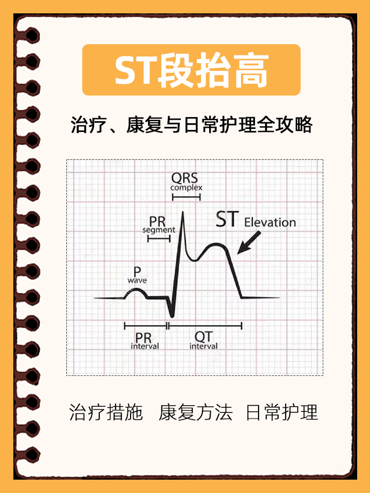 st段抬高:治疗,康复与日常护理全攻略