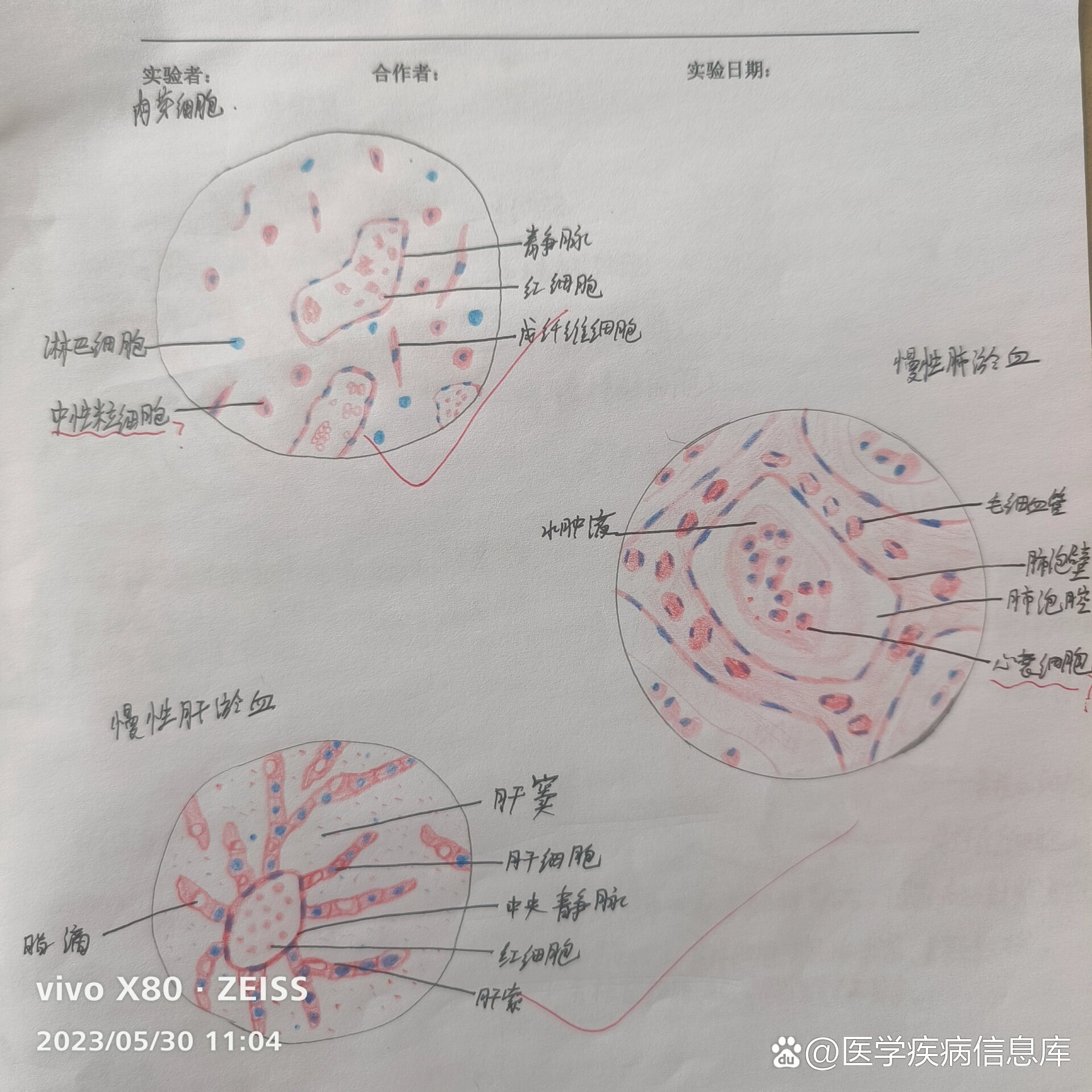 巨噬细胞的红蓝铅笔图图片