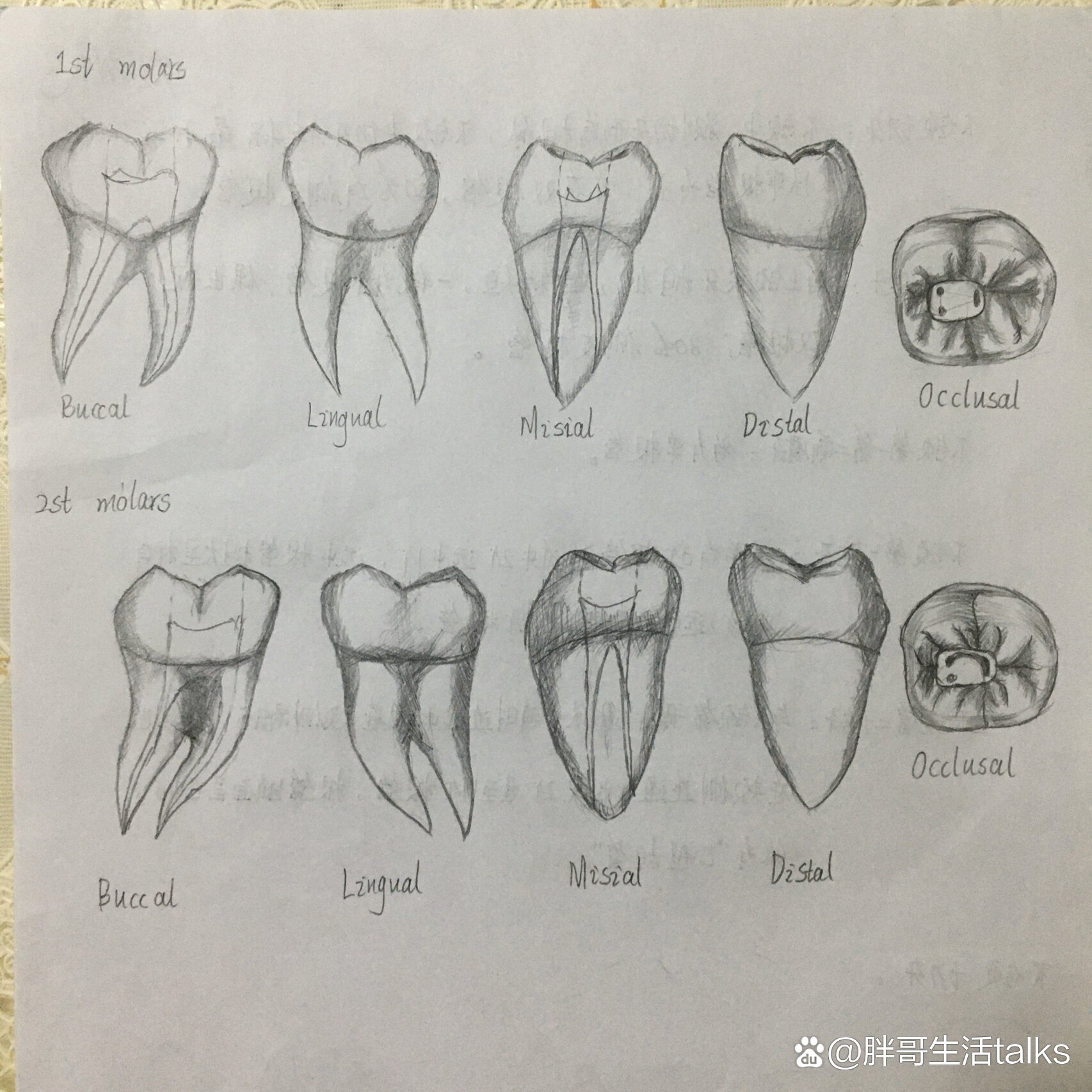 下颌六的开髓形态图片图片