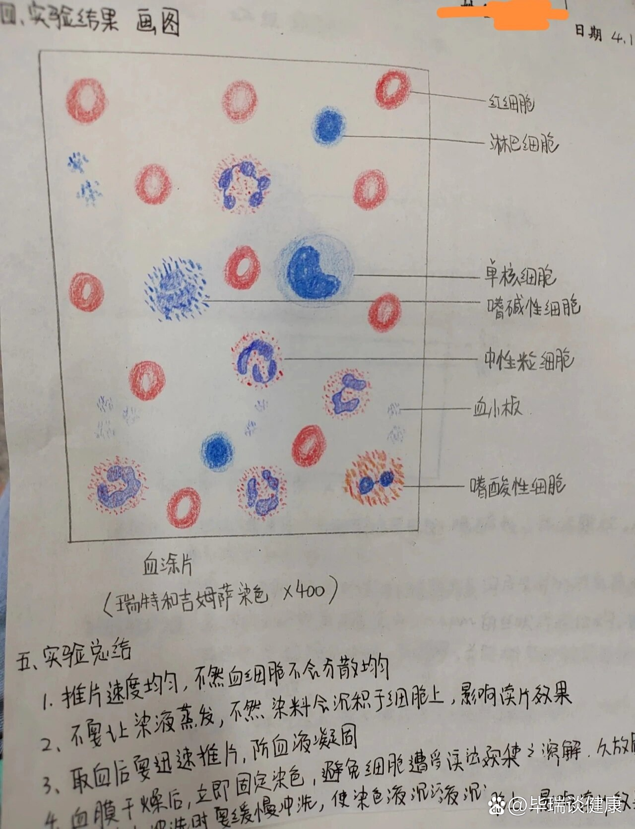 血涂片制作图片