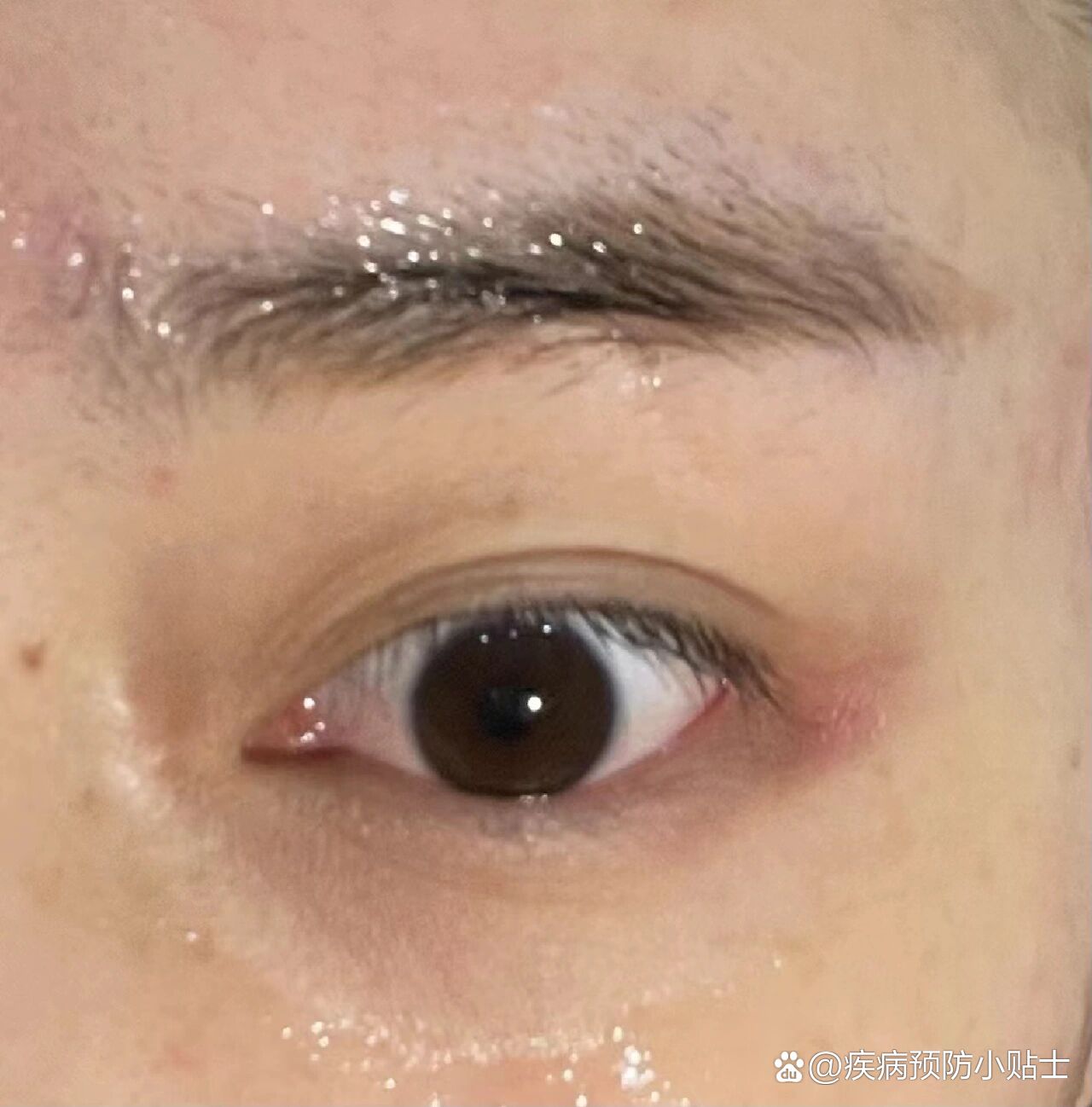 我这是怎么了眼尾又痛又红