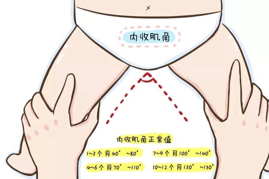 如下图,然后观察两个膝盖是否等高; br>2,髋关节外展试验 通常正常的