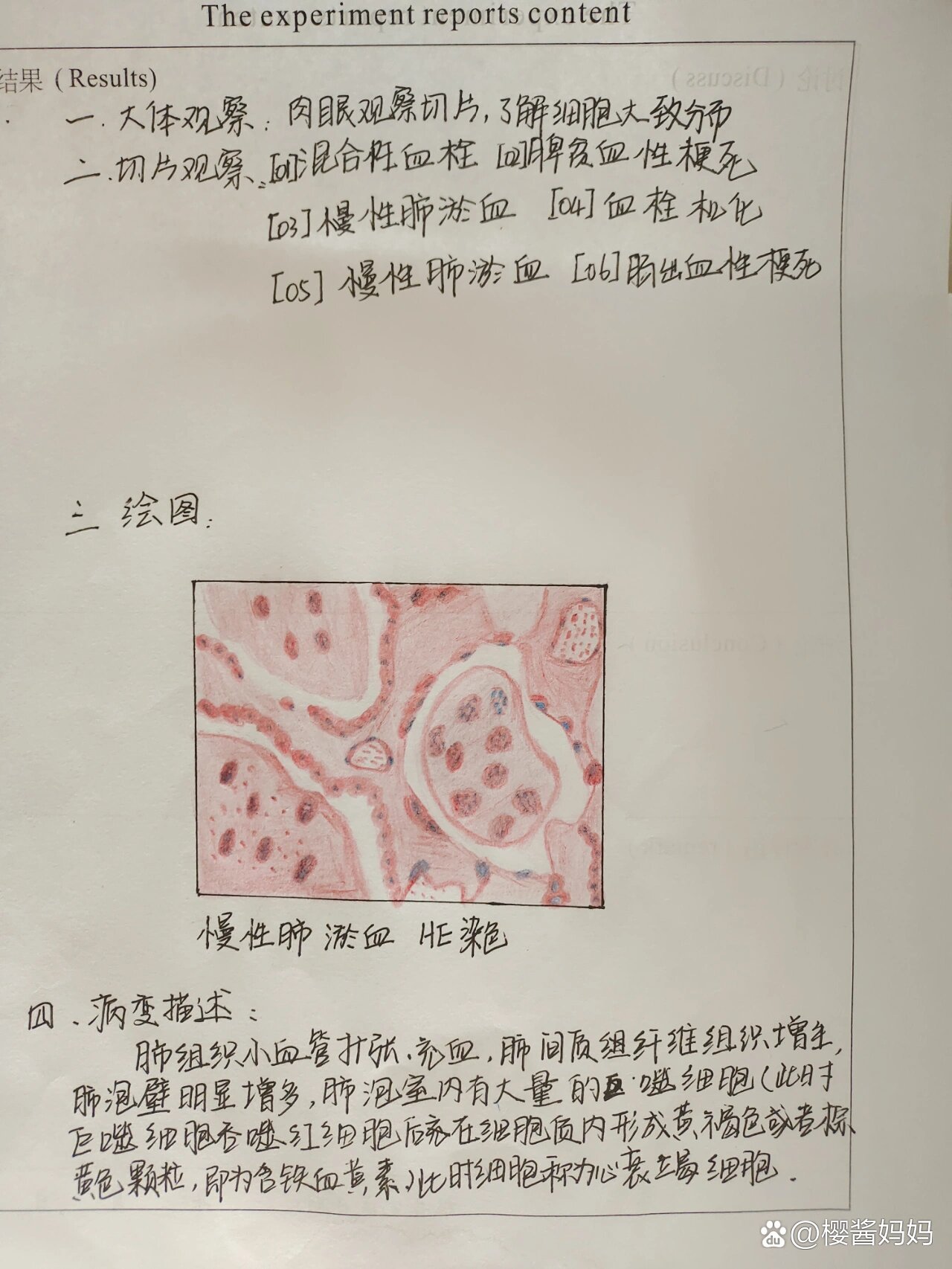 肺脓肿病理切片手绘图图片