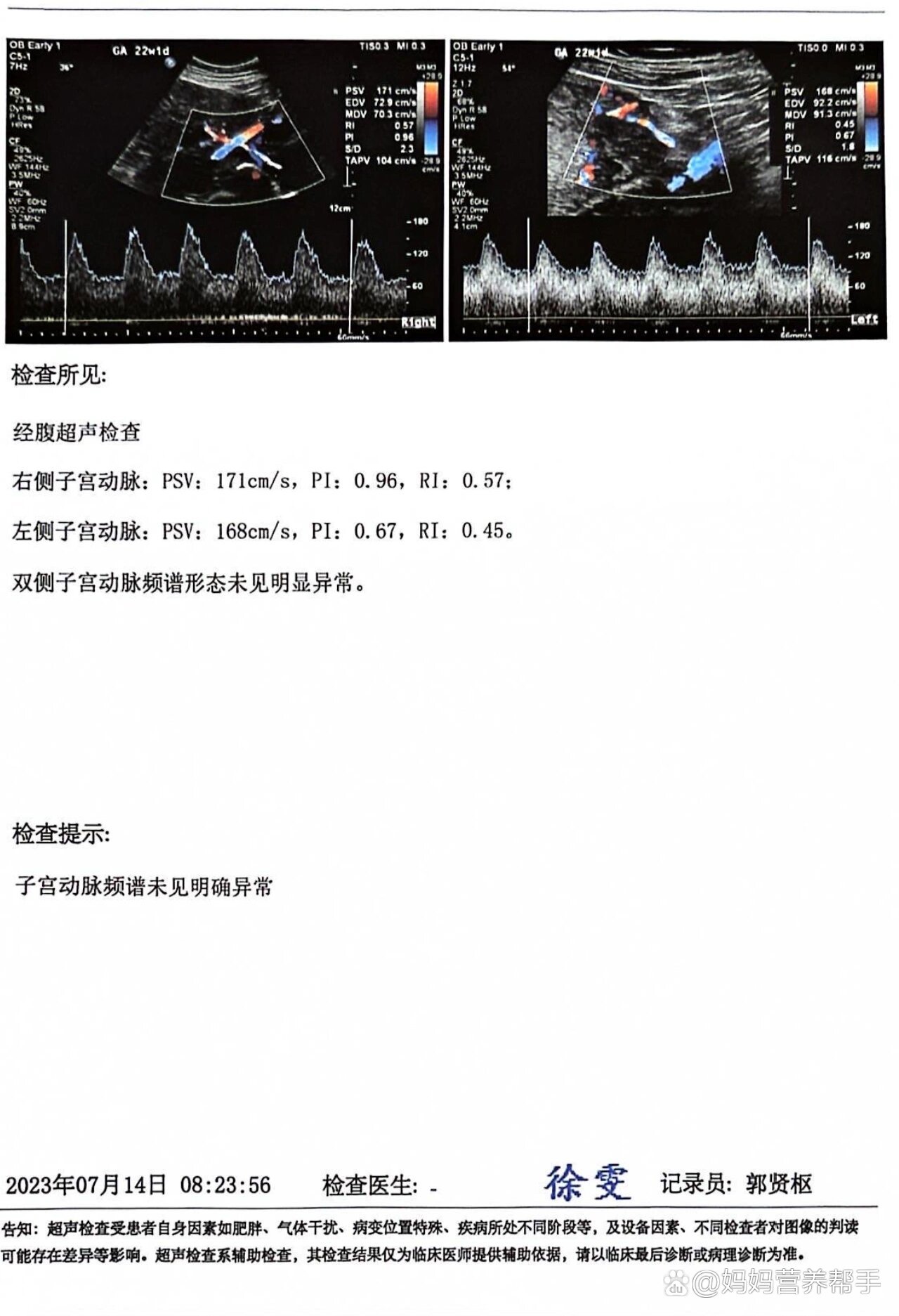 协和产检之大排畸