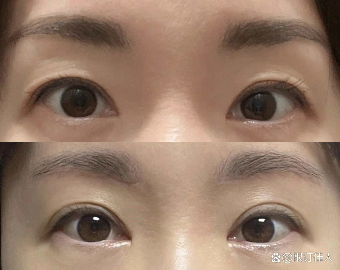 提眉前后