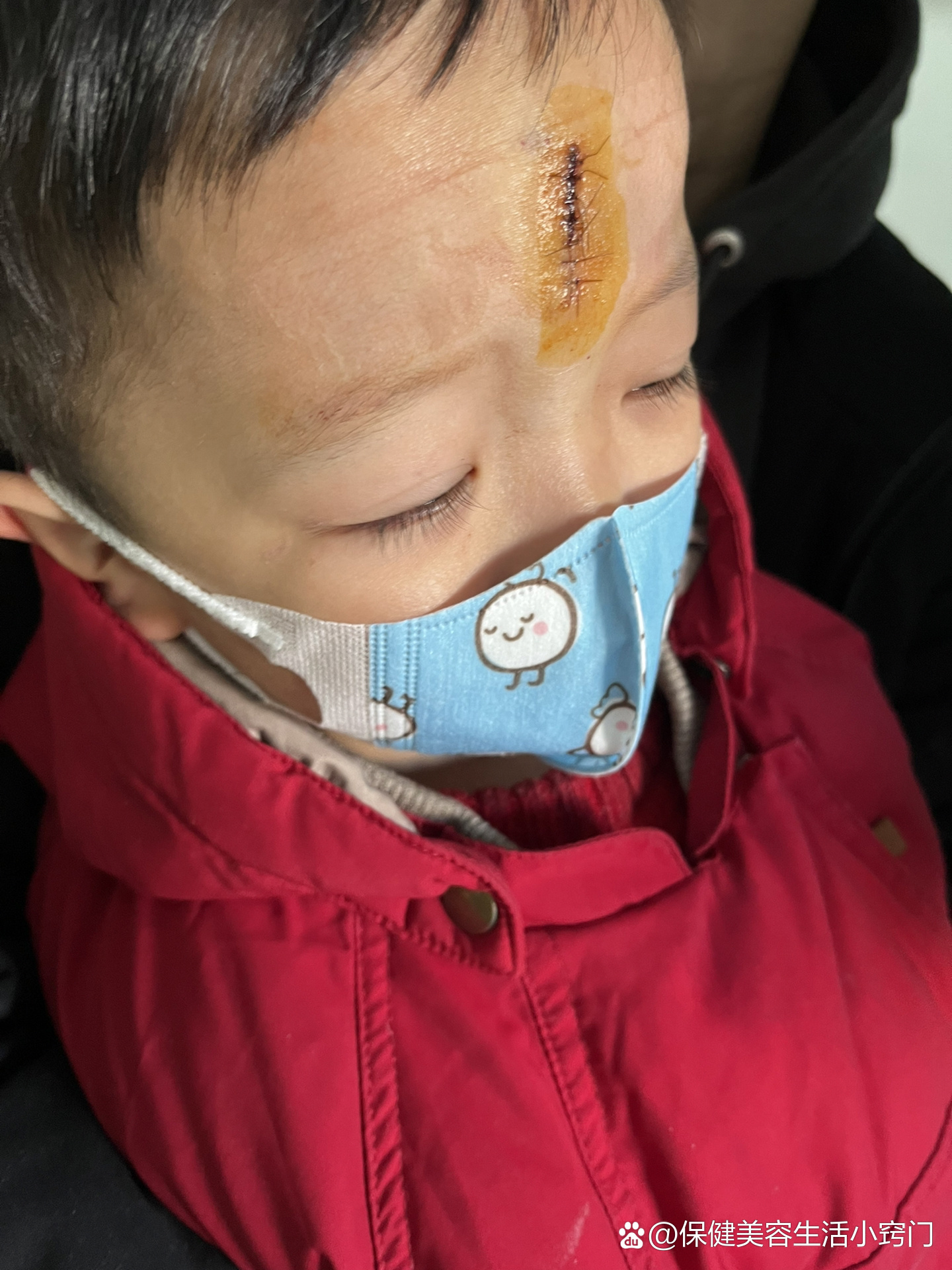 美容整形医院儿童缝合（美容整形医院儿童缝合多少钱）