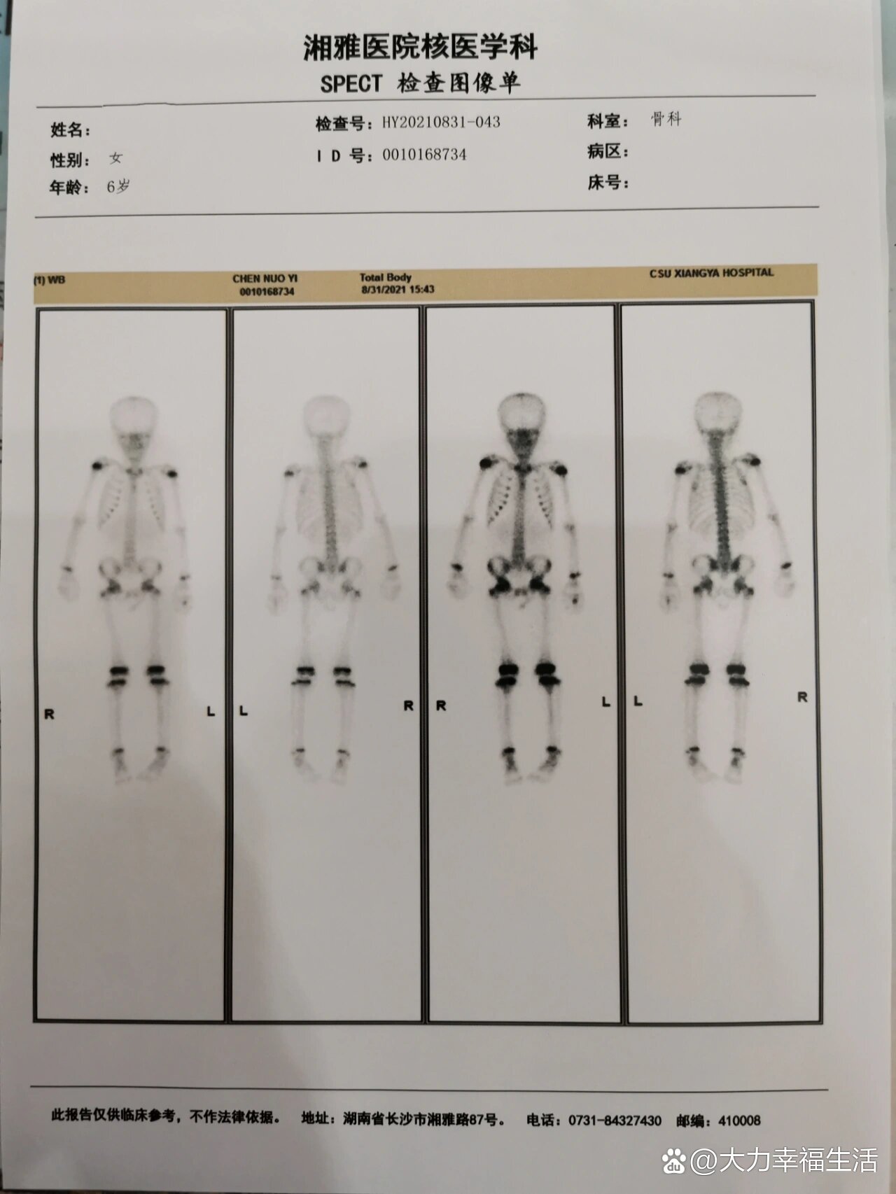 骨扫描检查结束了,心里石头落地了