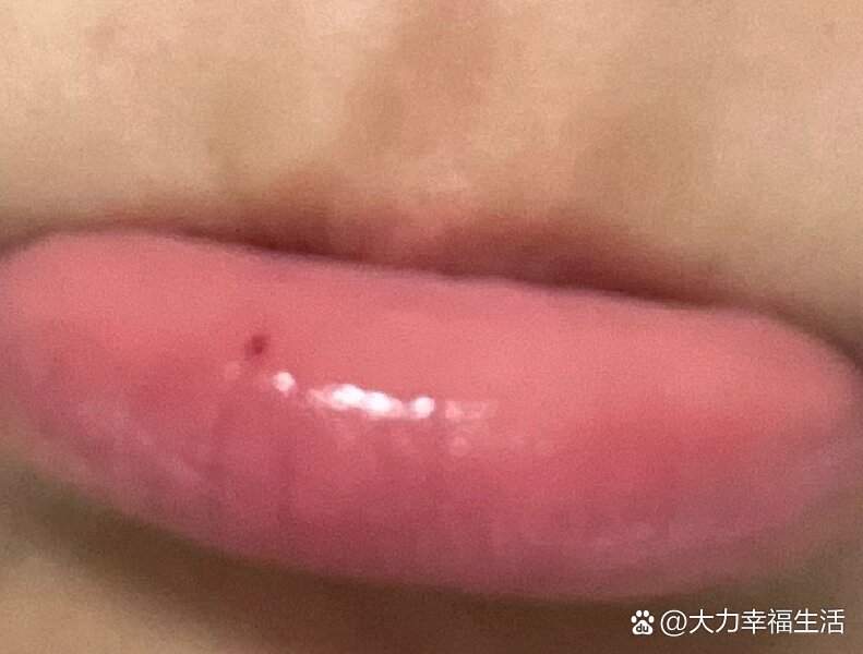 嘴唇边上长了小黑点