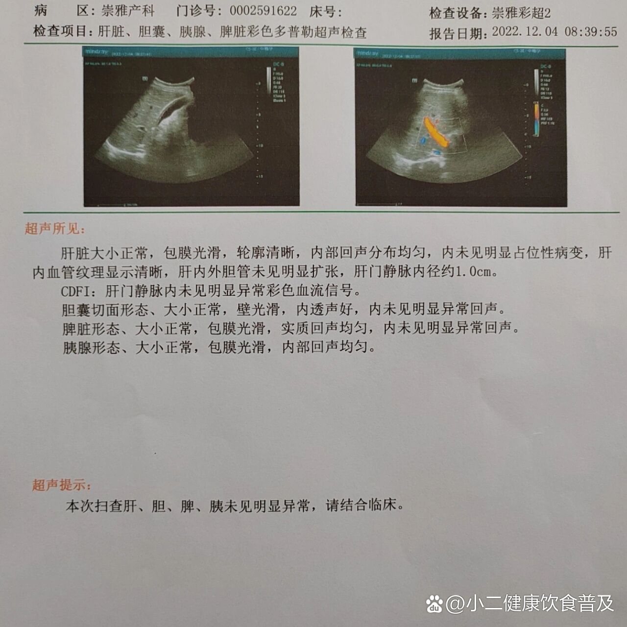 孕晚期 肝胆胰脾肾彩超顺利通过啦!