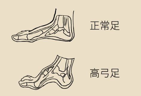 高足是指什么代称