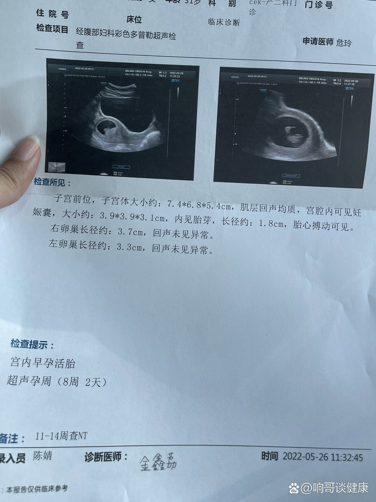 孕8周3天的b超来啦