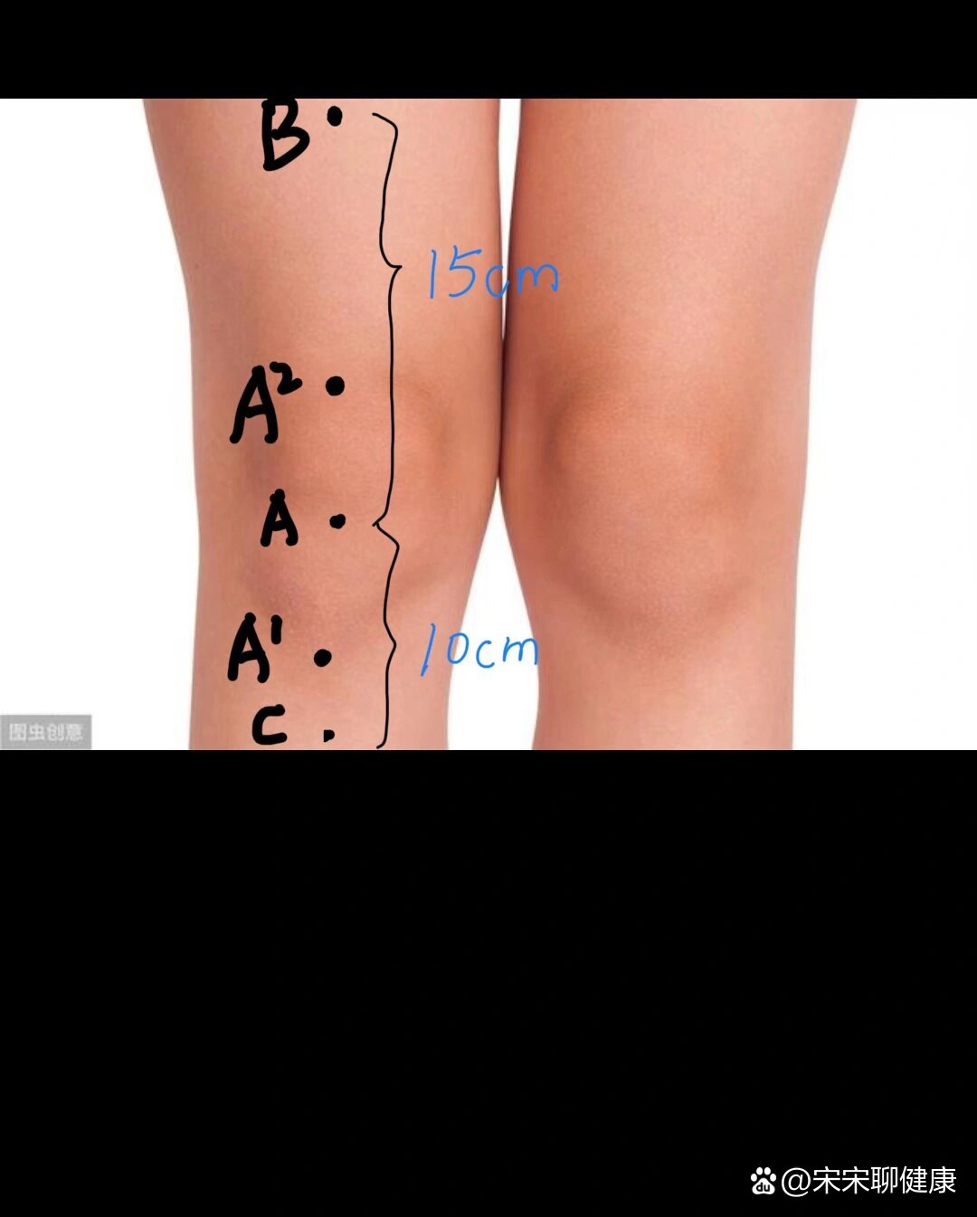 临床上如何测量腿围,快快学起来