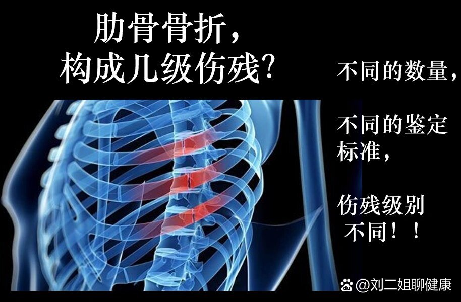 肋骨骨折几级伤残?