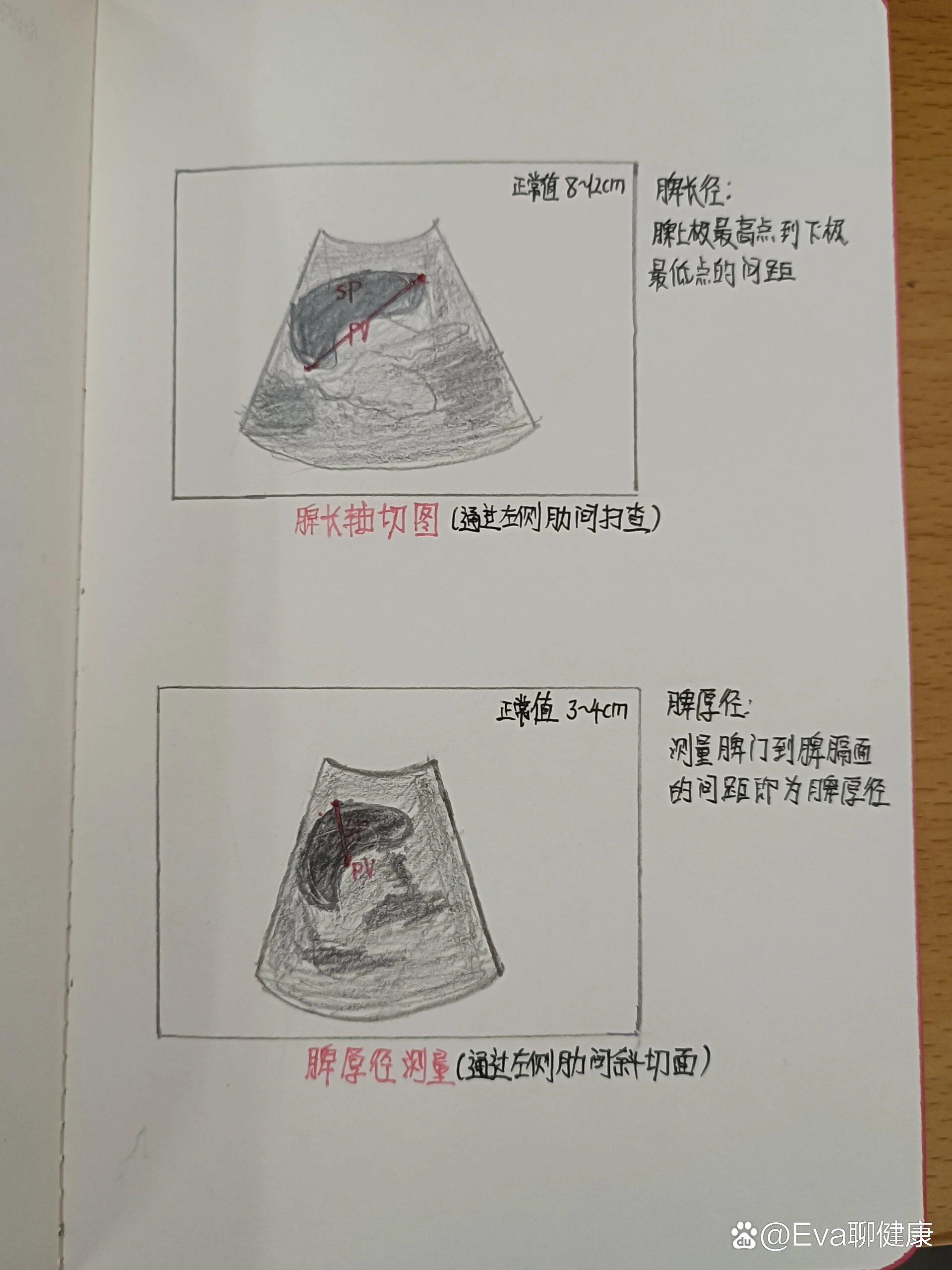 超声脾脏部分⬆️