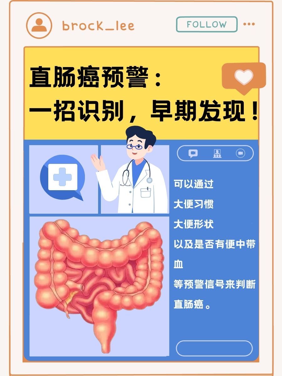 出现了腹泻以及大便带血的症状,我就特别焦虑,有些担心是出现了直肠癌