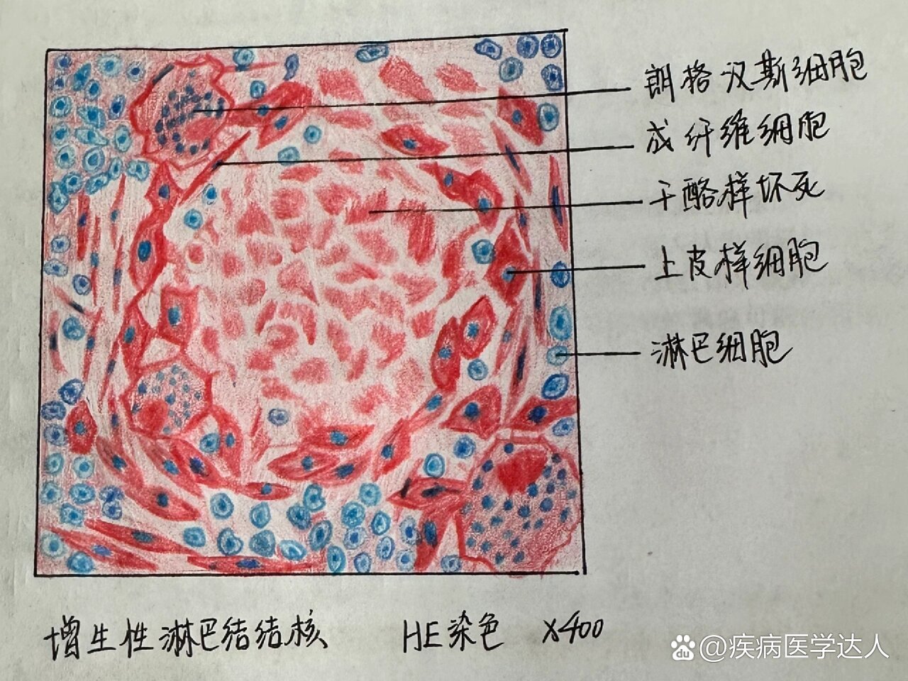 淋巴结皮质手绘图图片