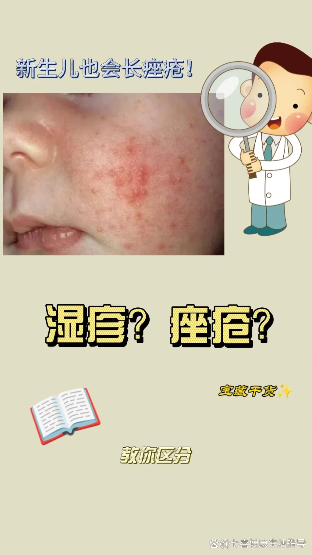 教你区分新生儿痤疮和湿疹 br>92我家宝宝出生后半个月开始脸上耳廓