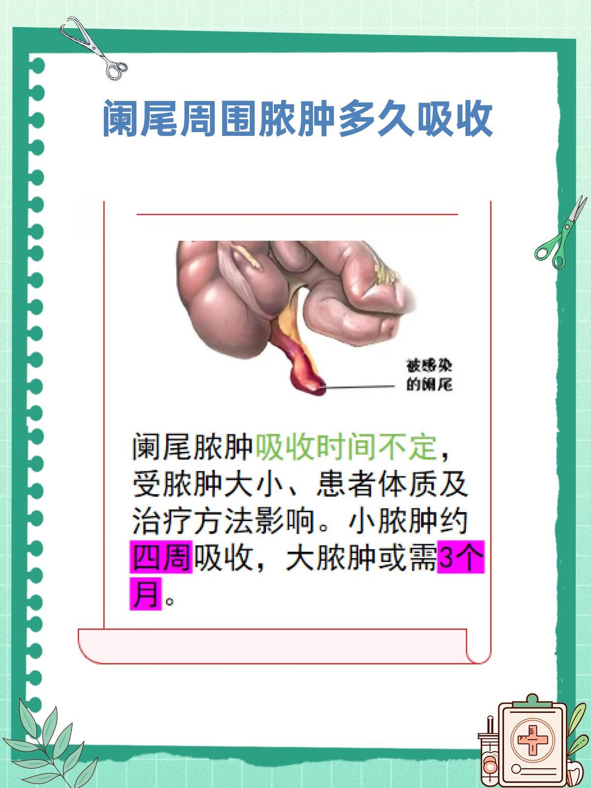 阑尾周围脓肿多久能消掉?一篇告诉你答案