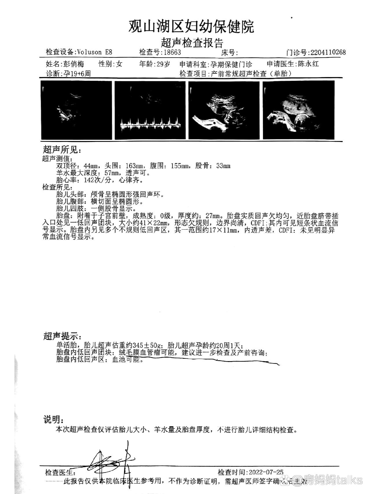 膜状胎盘超声图片图片