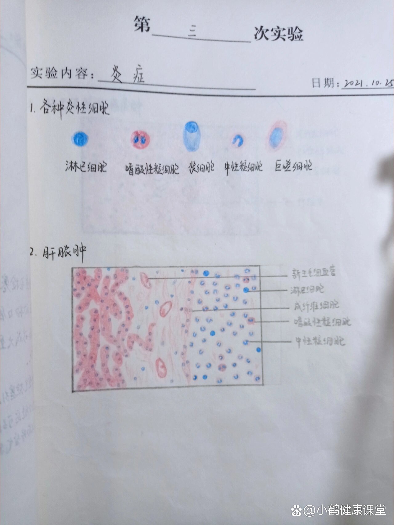 异物巨细胞红蓝铅笔图图片