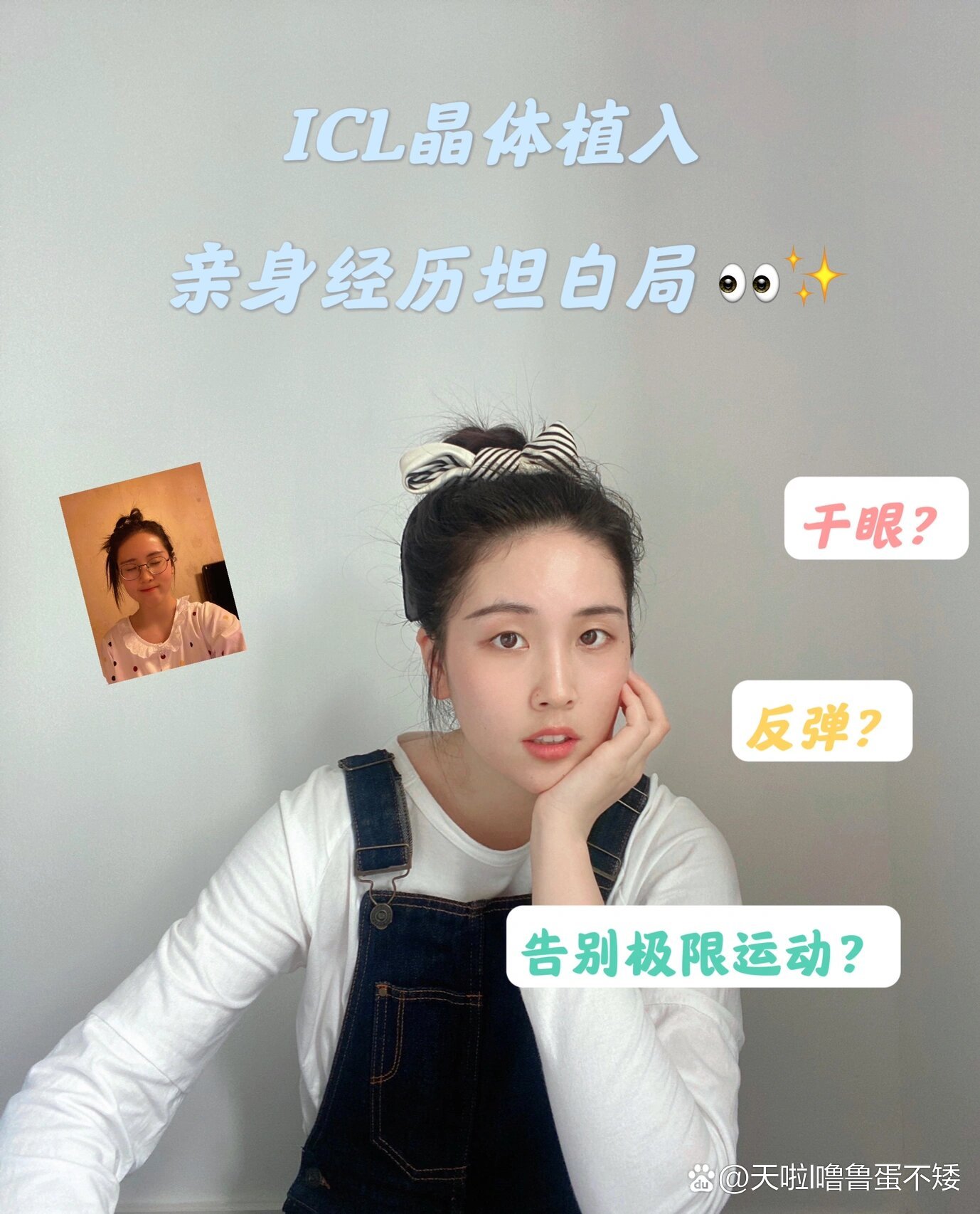  p>icl晶体植入坦白局98|后遗症及手术风险(上) br>手术时间:2021