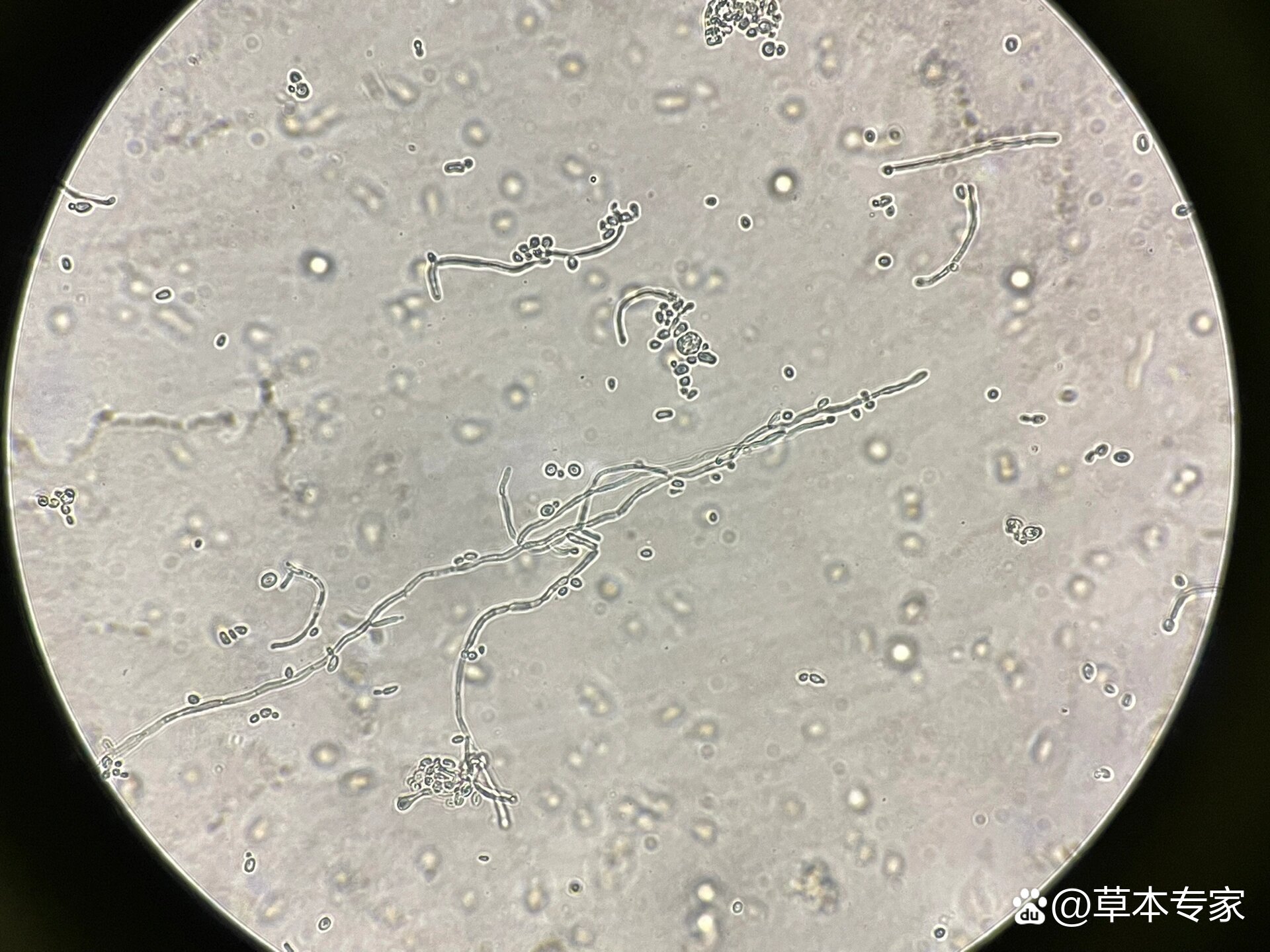 革兰染色真菌形态图图片