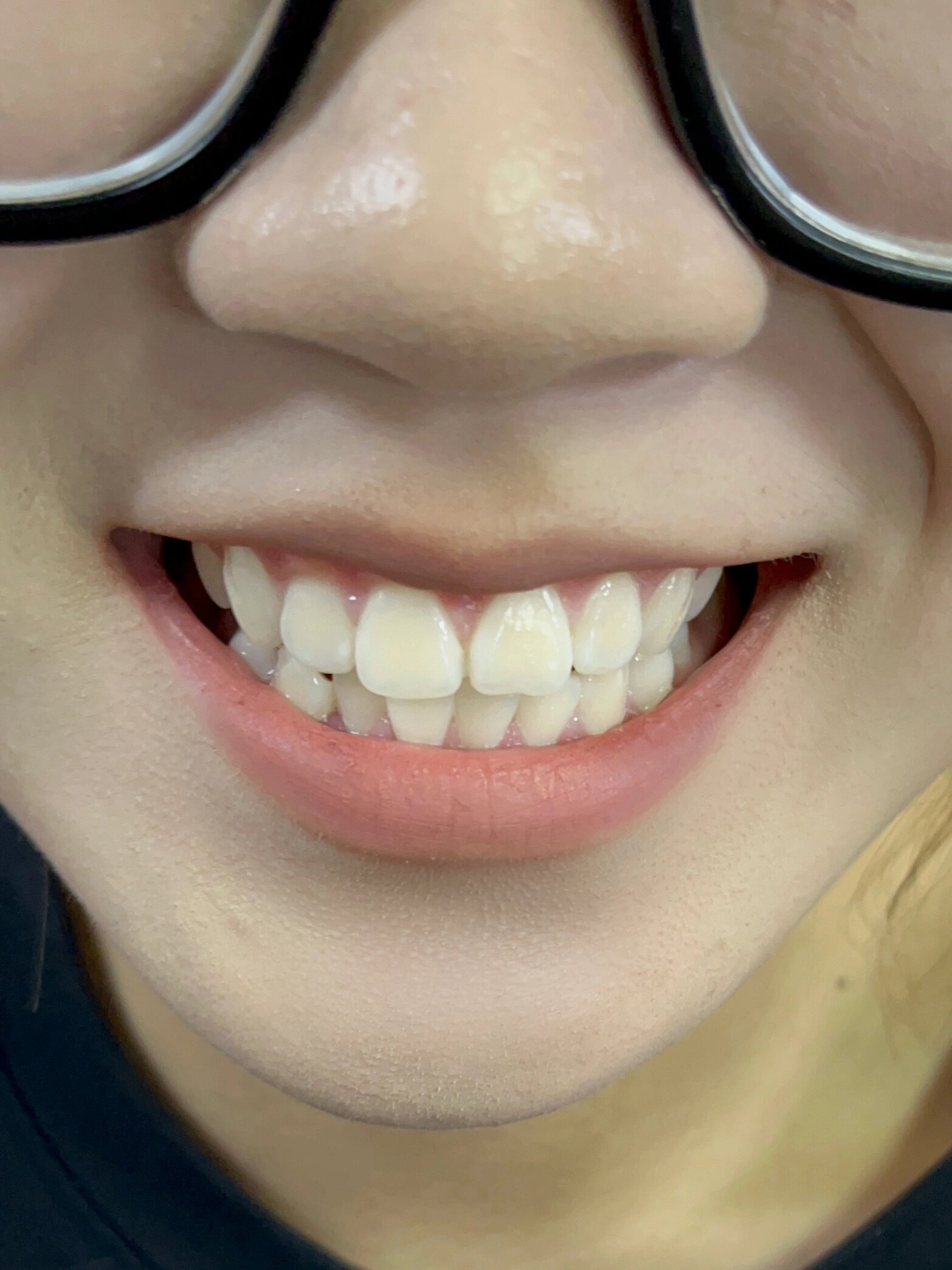 为什么牙可以白的这么自然?