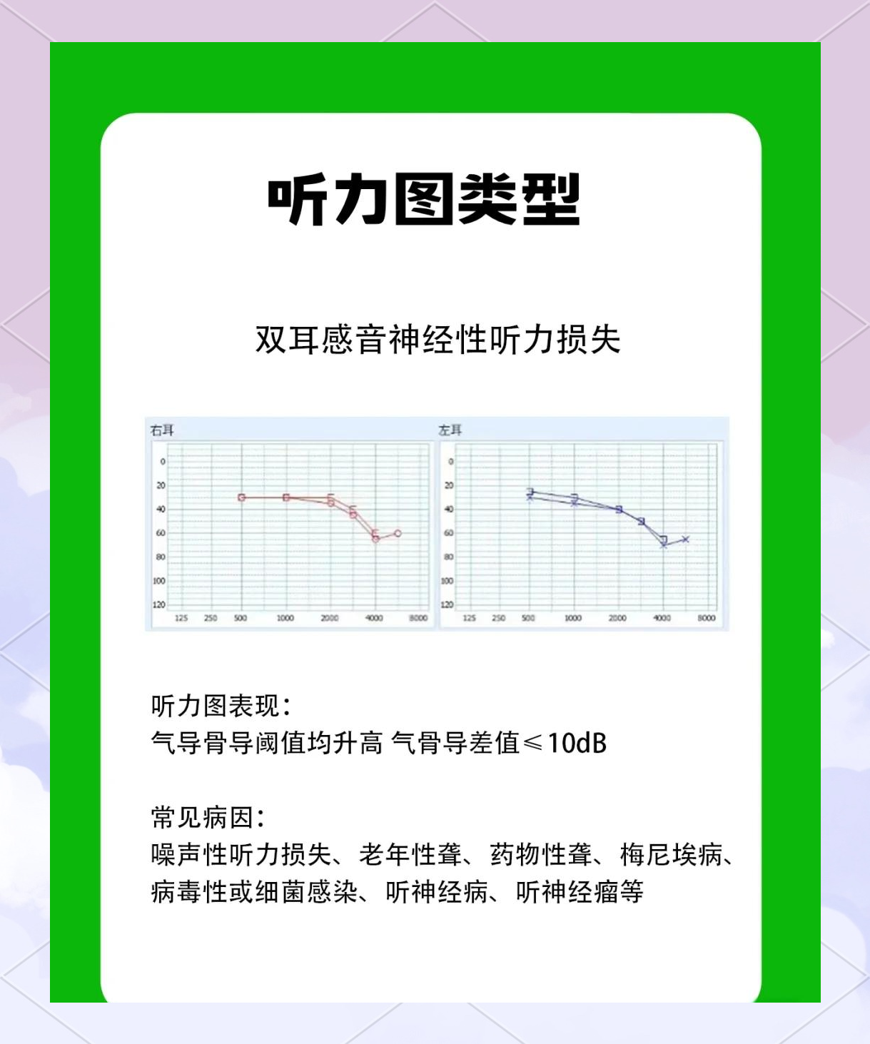 看懂听力图：这些曲线你得留意！