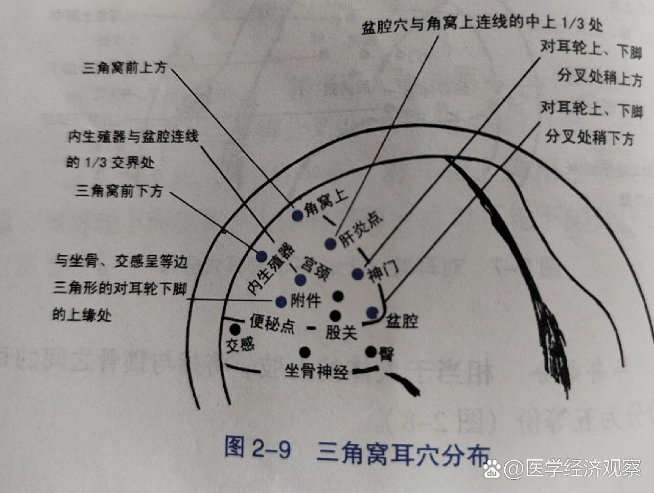 中医【耳穴定位】疗法:三角窝位置穴位分布
