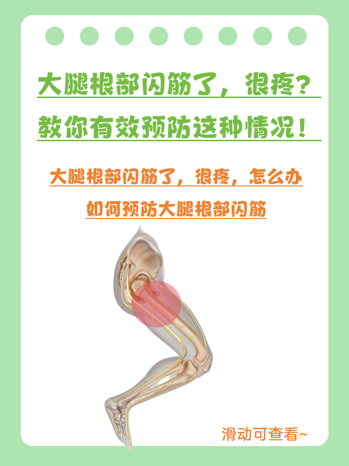 大腿根部闪筋了,很疼?教你有效预防这种情况!