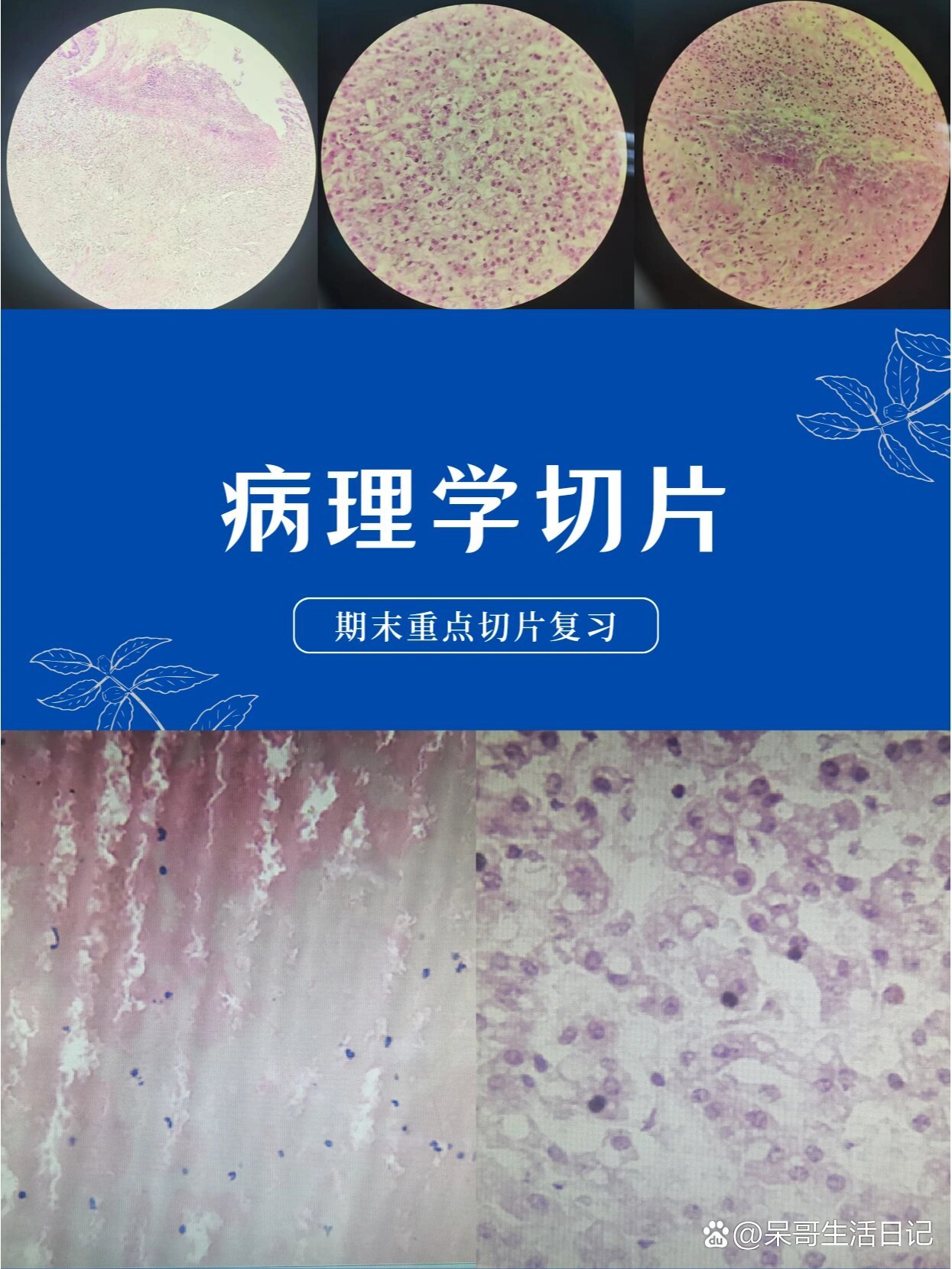 p>病理学|期末切片复习③ br>95纤维素性心包炎(图二～图四)  br>