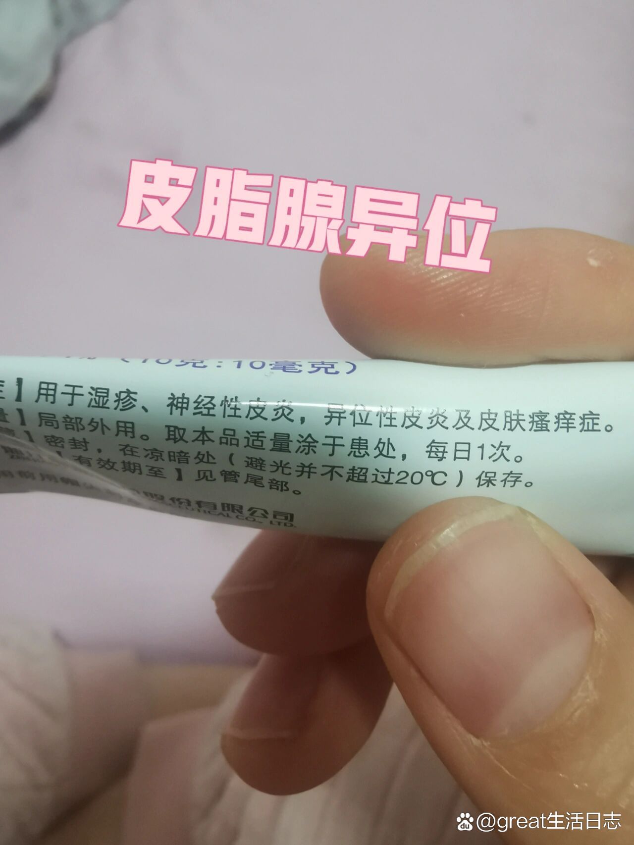 皮脂腺异位怎么治图片