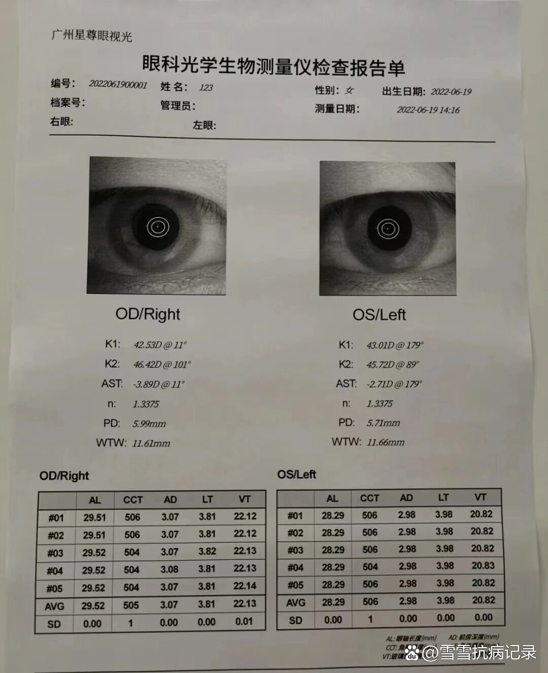 眼底检查全过程