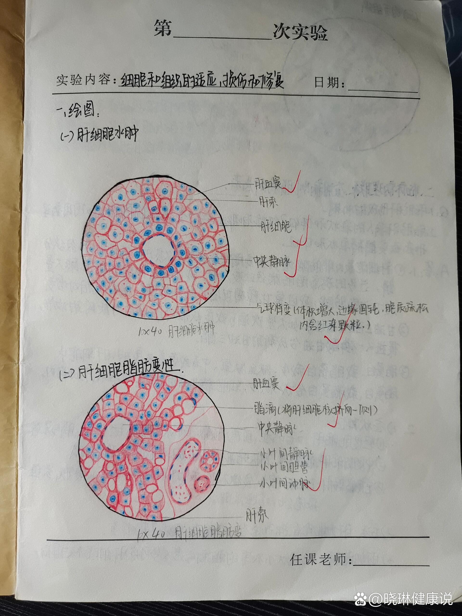 伤寒红蓝铅笔图图片