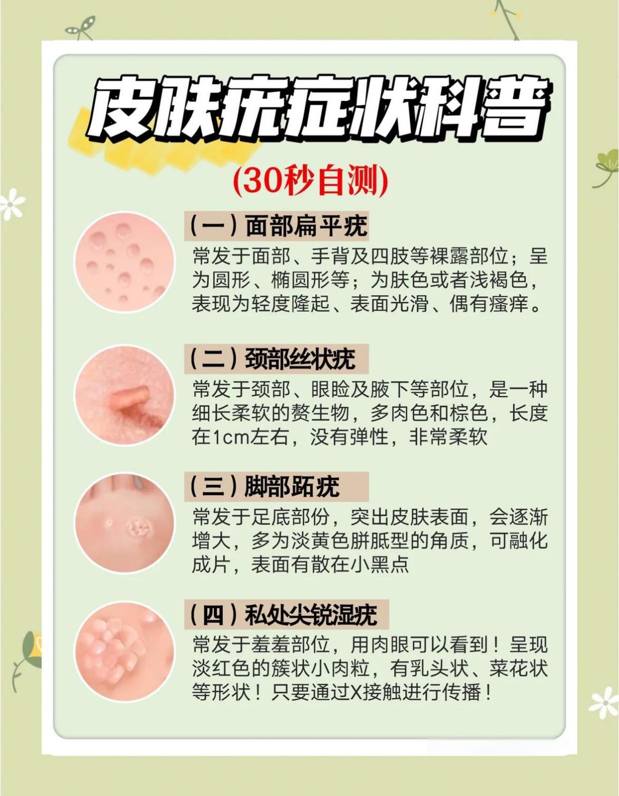 长疣了怎么办？