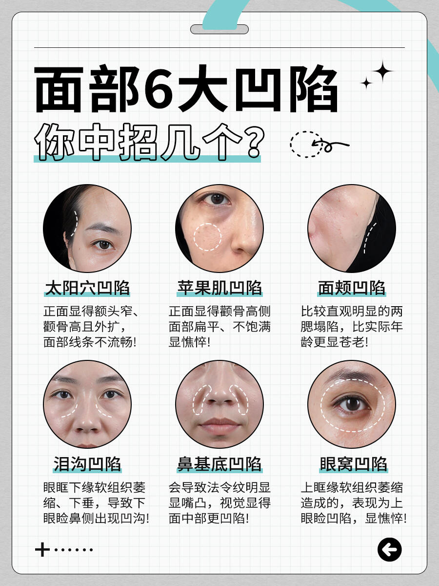 面凹有救了‼️一次性讲清面部凹陷该怎么办