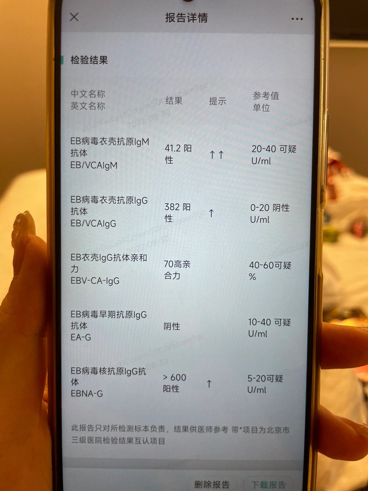 eb病毒化验单