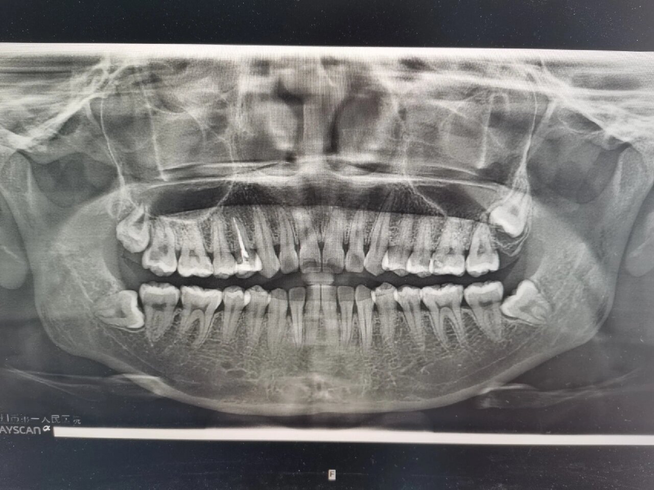 关于北京大学口腔医院黄牛排队挂号CT加急挂号黄牛的信息