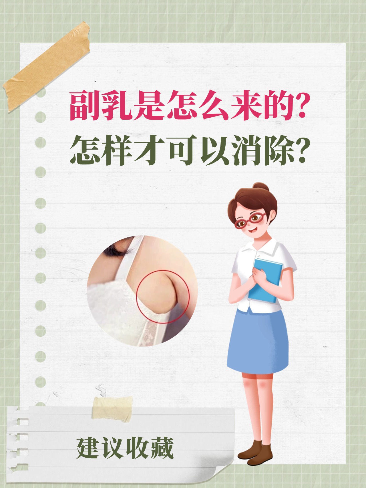 副乳是怎么来的?怎样才可以消除?