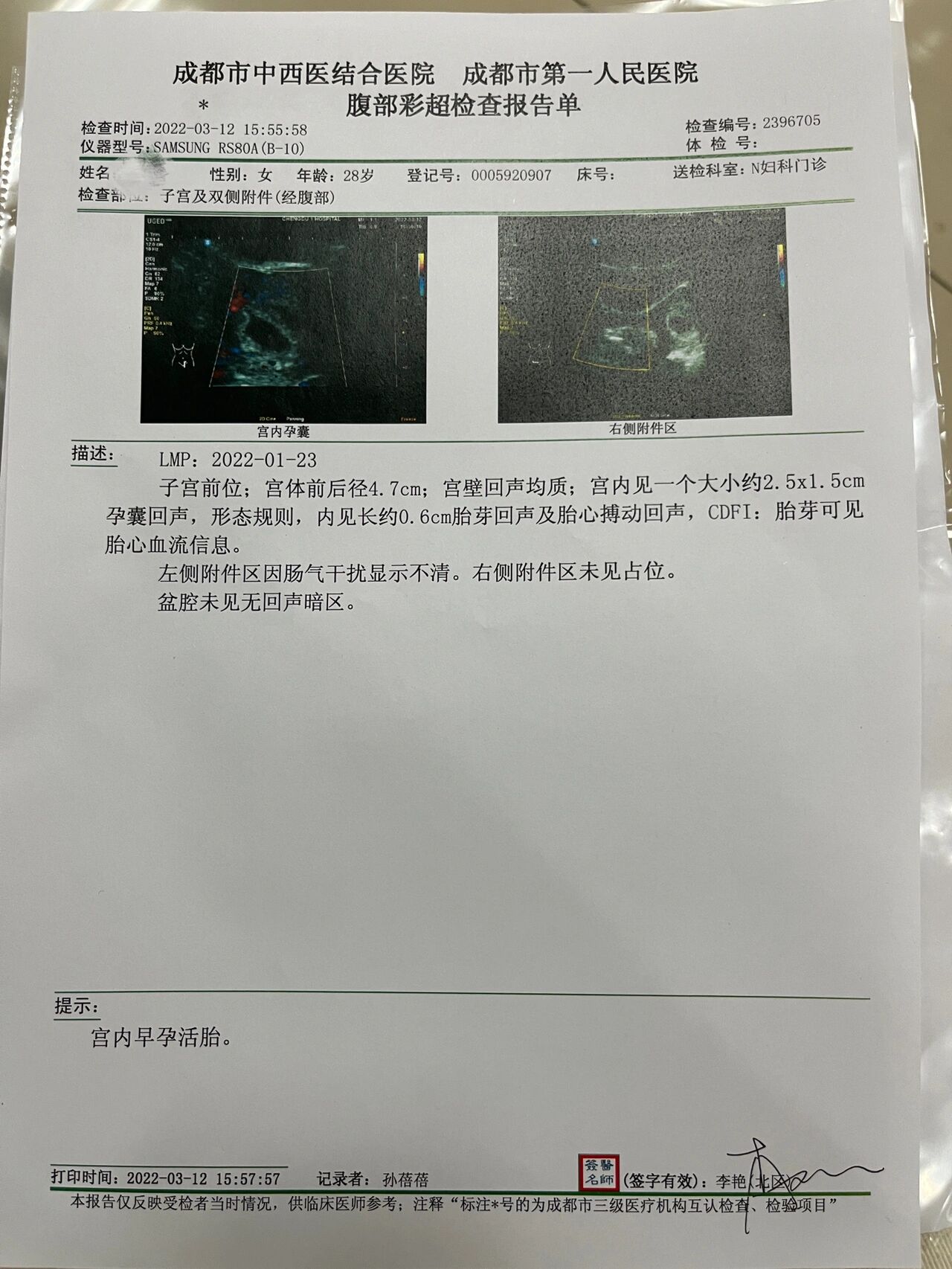 怀孕6周孕囊大小图片