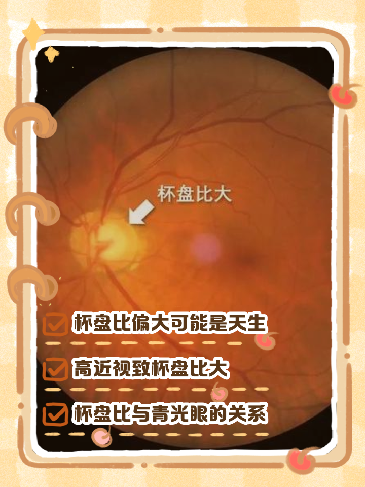 杯盘比偏大是何原因