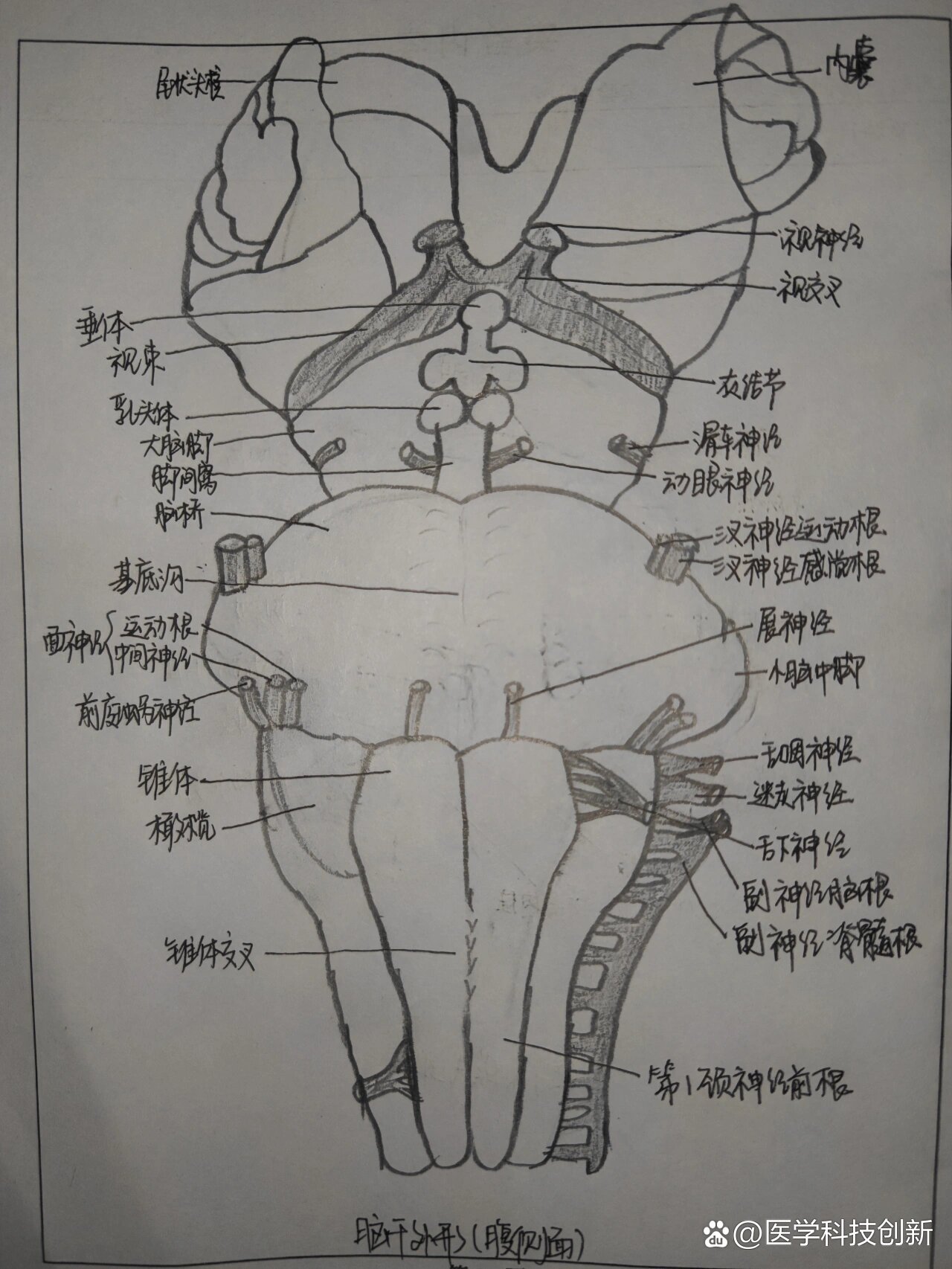 脑干腹侧面观图片