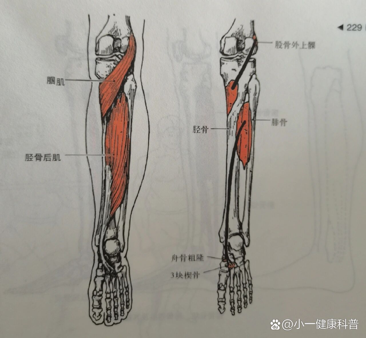 胫骨后肌肌腱图片