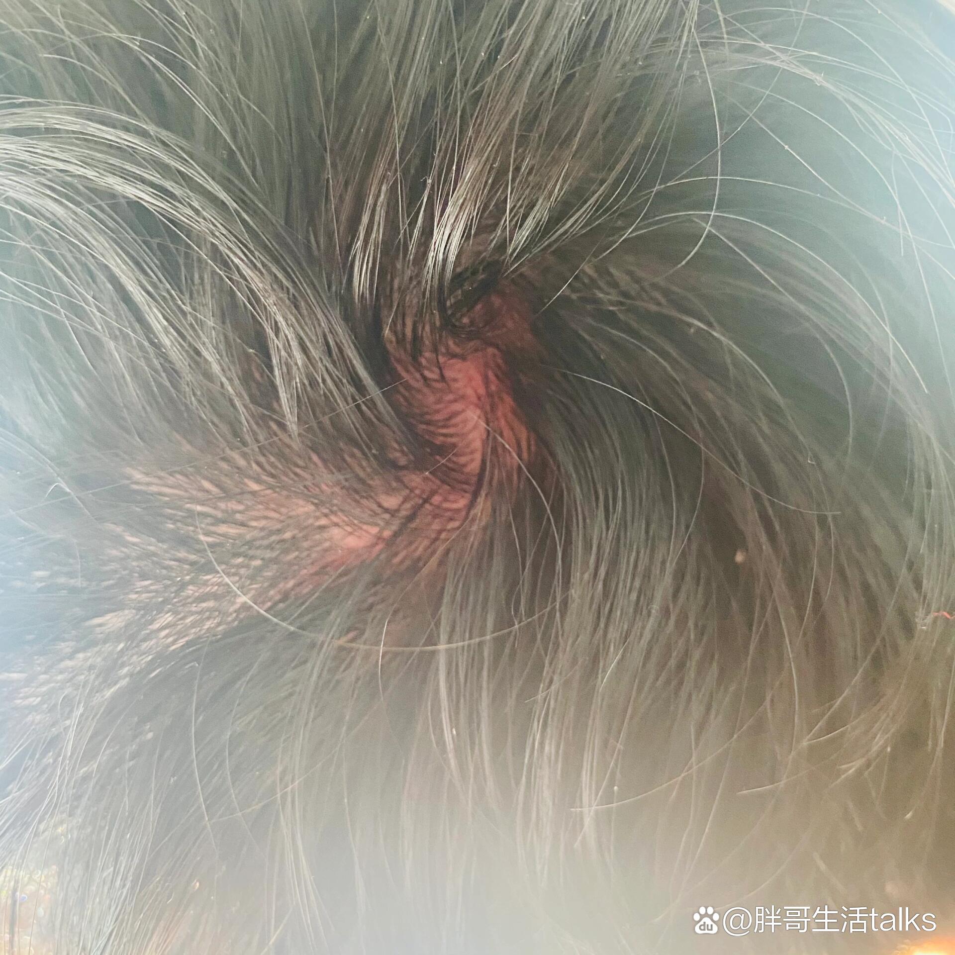  p>头发被薅了 br>打架头发被薅了要怎么办啊 /p>